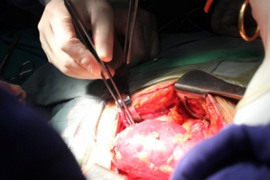 Chuyện rùng rợn ở đường dây bán nội tạng xuyên biên giới Việt